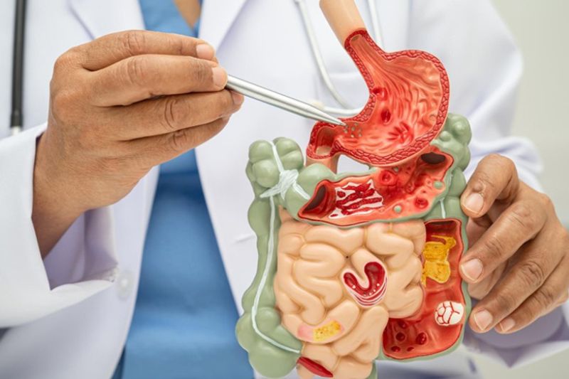 ERCP Services