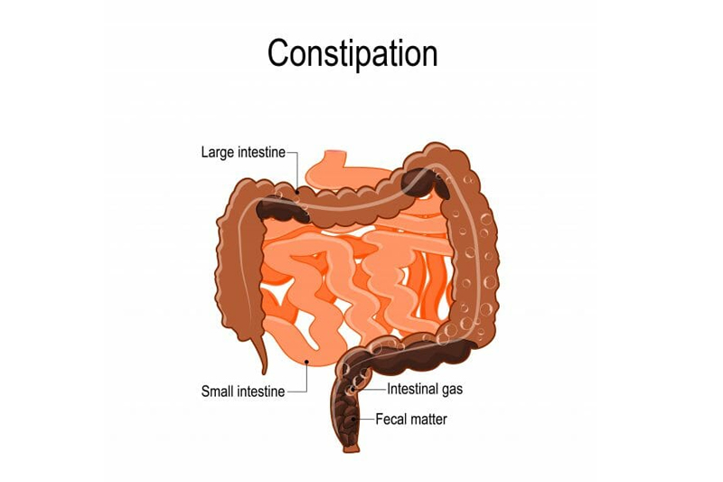 Constipation Treatment Doctor In Nanded