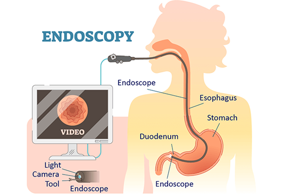 Endoscopy Specialist In Nanded