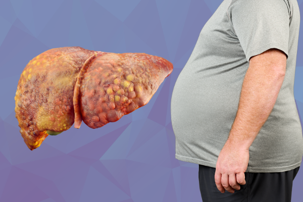Fatty Liver Treatment In Nanded