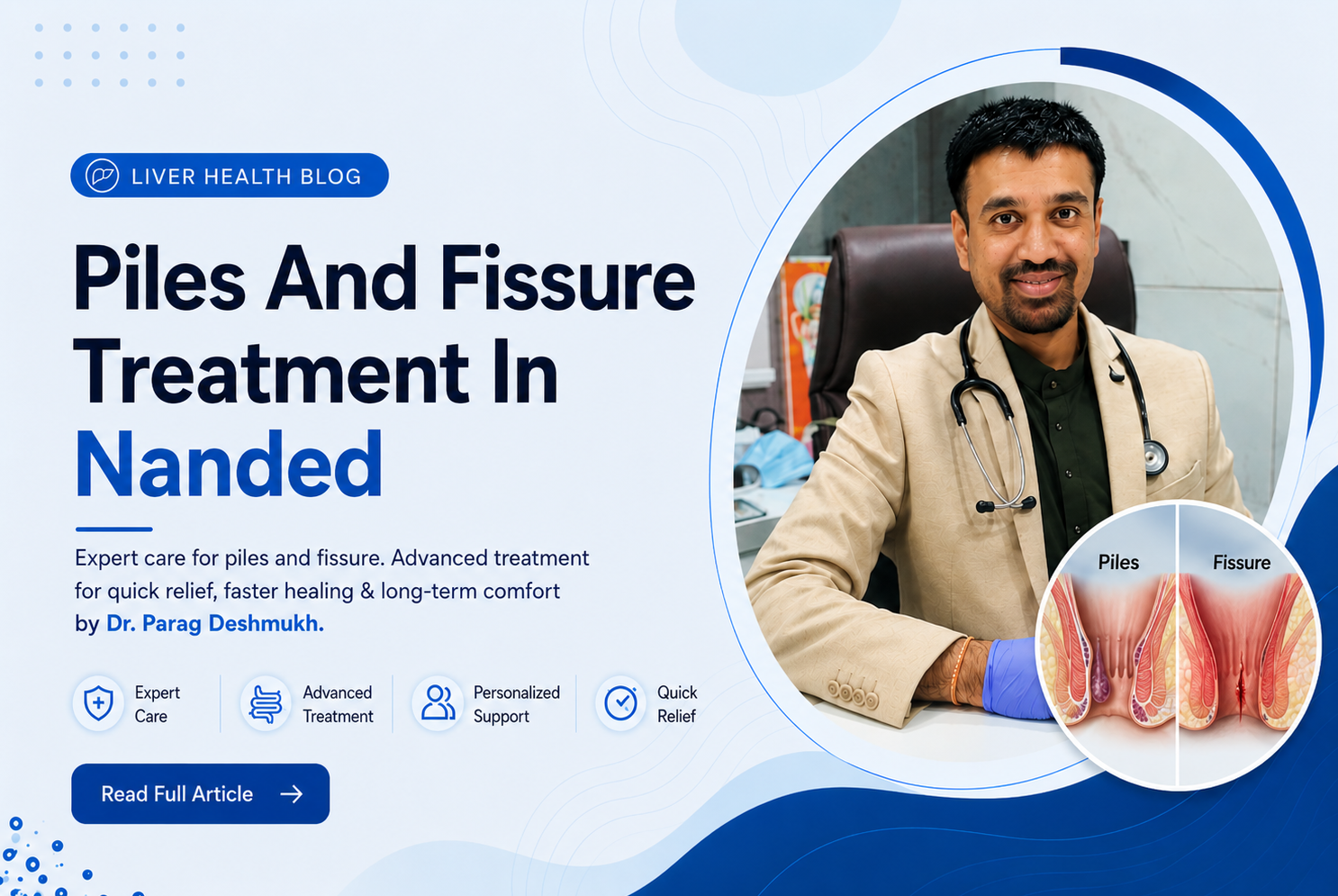Piles And Fissure Treatment In Nanded